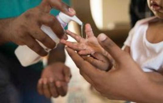 Qual deve ser o contato das crianças com o álcool em gel?