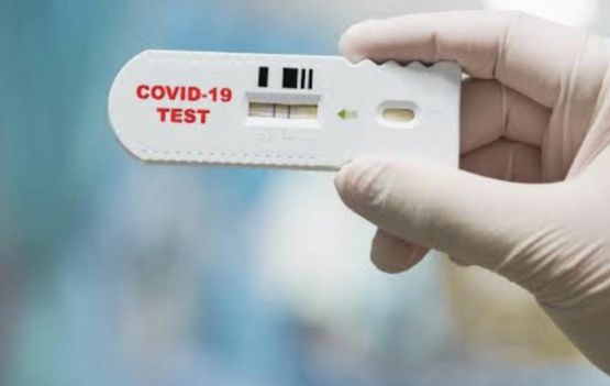 Testes em bairros detectam 22 casos positivos para Covid-19 hoje (15)